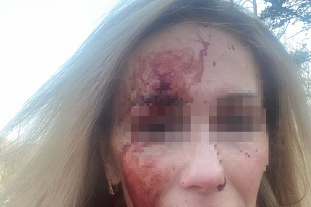 В Новосибирске водитель Volkswagen избил женщину рядом с клиникой Мешалкина
