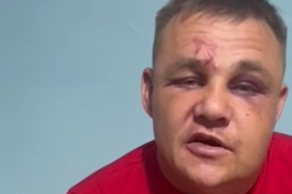 Ветеран СВО, на которого напали в Забайкалье, призвал обойтись без самосуда