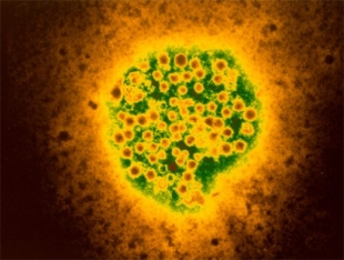 hpv 16 virus loswerden
