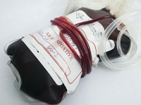 Можно ли пить красное вино после сдачи крови