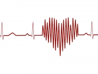 Профилактика инсульта при мерцательной аритмии сердца