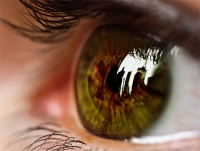 Как убрать синяки под глазами и почему они появляются