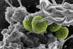 Бактерия метициллин-резистентного стафилококка (зелёный цвет) с клетками человека (белые). Эти бактерии вызывают сложно излечимые заболевания, такие как сепсис и пневмония.