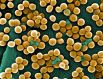 Бактерия золотистого стафилококка. Около 20% населения Земли являются постоянными носителями этой бактерии. Она сохраняется на кожных покровах и слизистых оболочках верхних дыхательных пытей.