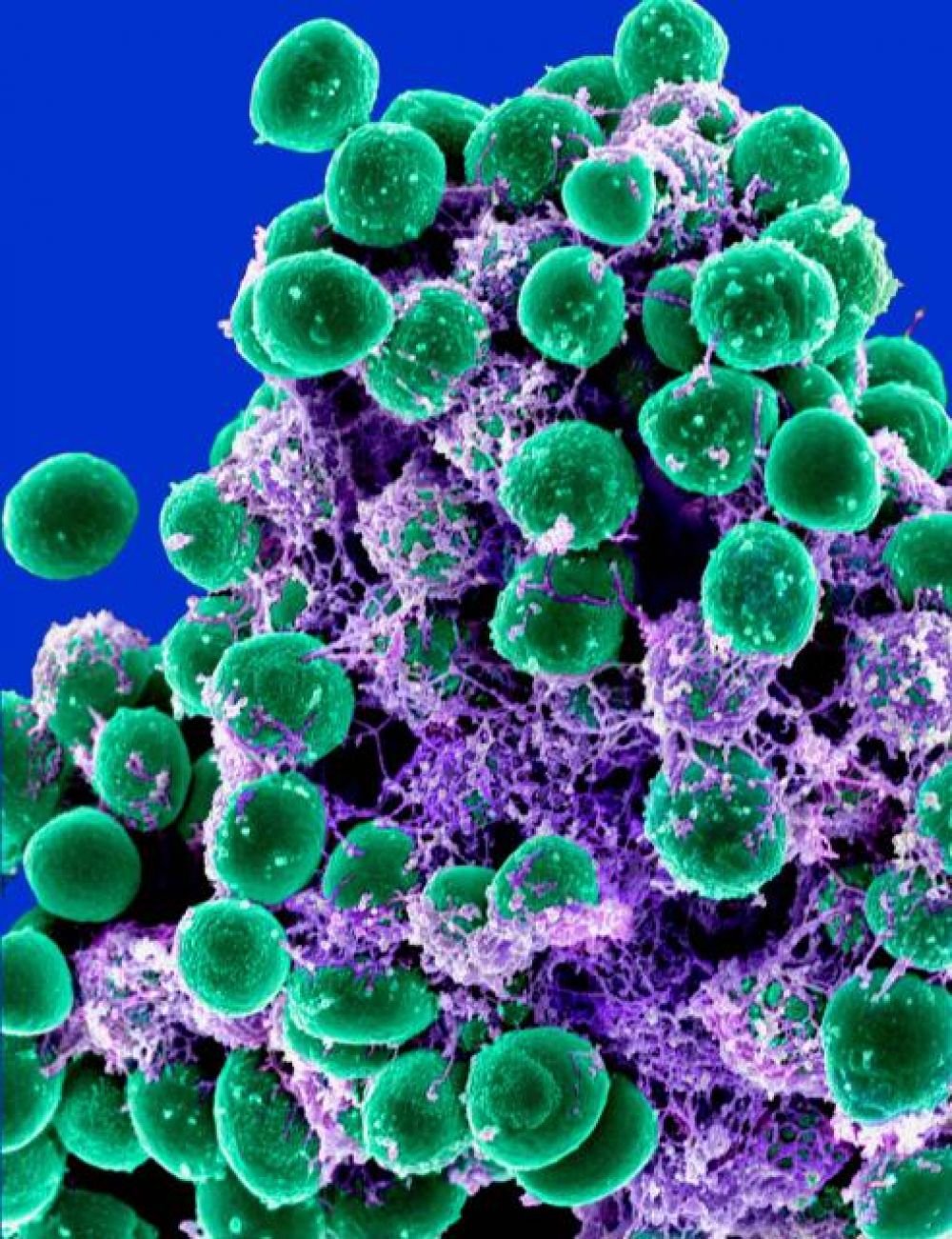 Бактерии фотографии под микроскопом