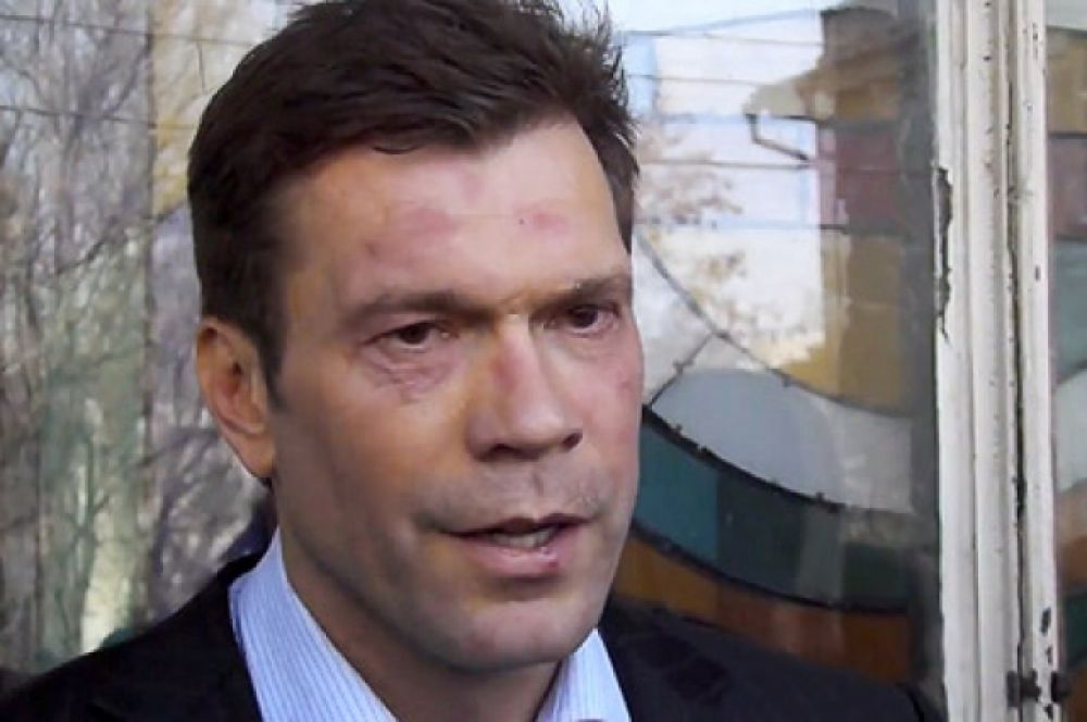 Царев получил по лицу в Николаеве