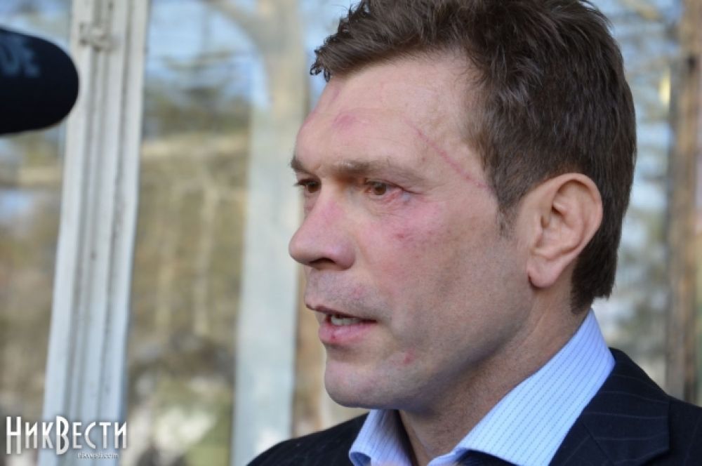 Царев получил по лицу в Николаеве