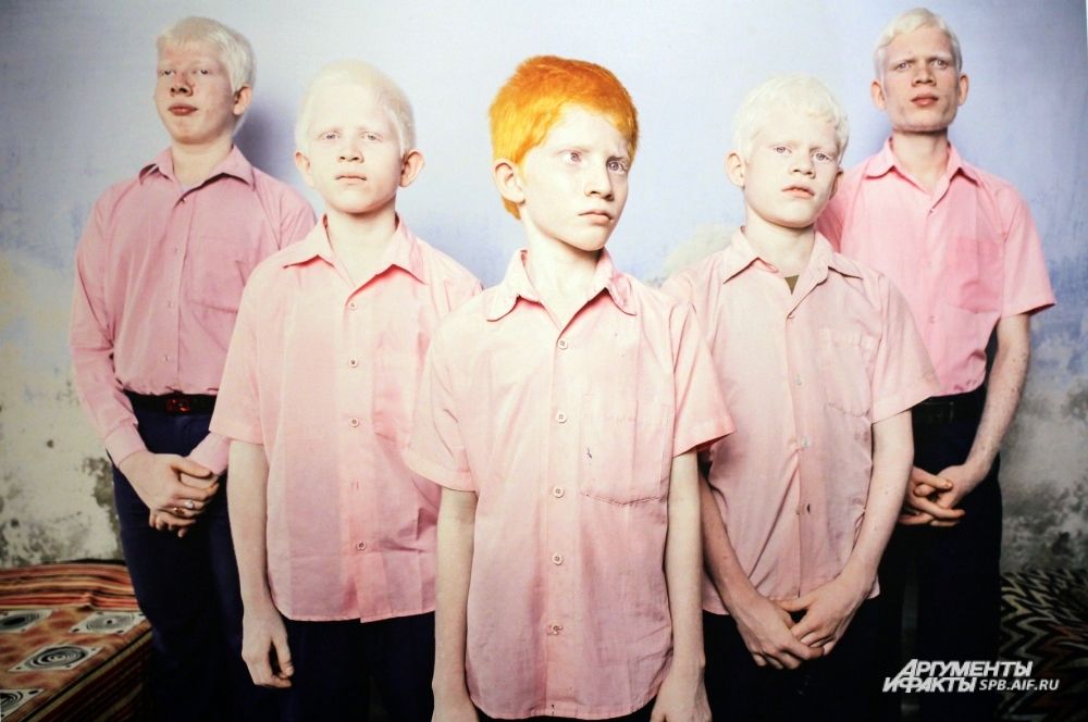 Фотограф Брент Стиртон (ЮАР) сделал портрет слепых мальчиков-альбиносов в интернате в Вивекананде, Западная Бенгалия.