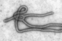 Вирус лихорадки Эбола.
