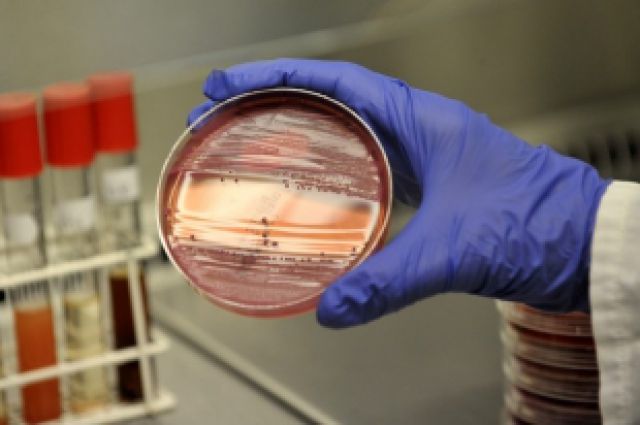 Результаты проведенных лабораторных испытаний смывов показали наличие бактерий группы кишечной палочки на инвентаре и оборудовании в кухонном помещении детсада.