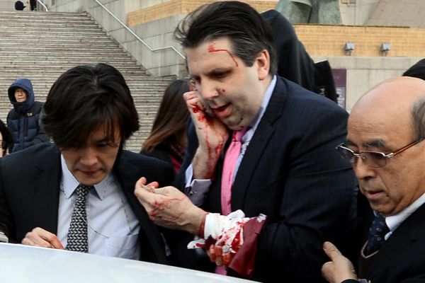 Посол США в Южной Корее Марк Липперт после нападения.