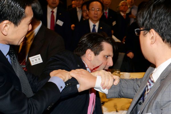 Посол США в Южной Корее Марк Липперт после нападения.