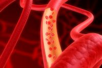 Какой должен быть холестерин после инфаркта и стентирования