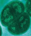 1-е место - Бактерия Deinococcus Radioduran, одна из самых устойчивых к действию ионизирующего излучения бактерий.