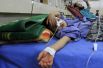 Маленький мальчик, пострадавший в результате катастрофы, в больнице Джалал-Абада, Афганистан. 