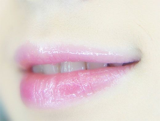 Как лечить обветренные губы?
