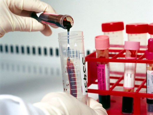 ...Как лечить атеросклероз нижних конечностей? | Вопрос-Ответ ...