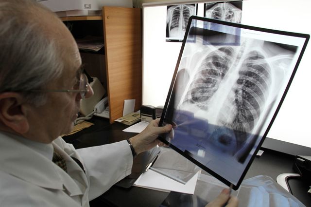 Чем отличается рентген легких от мрт