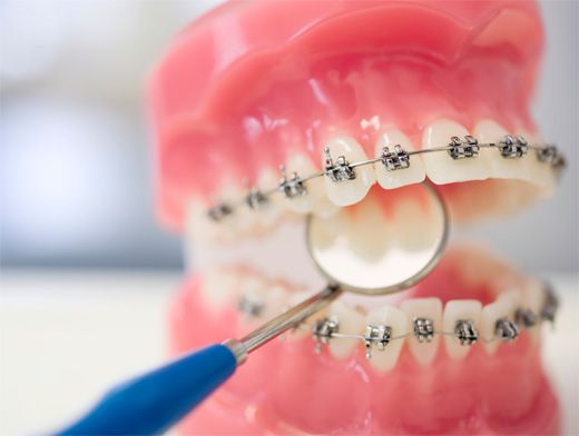 Тошнит от зубных протезов. Какие есть альтернативы?