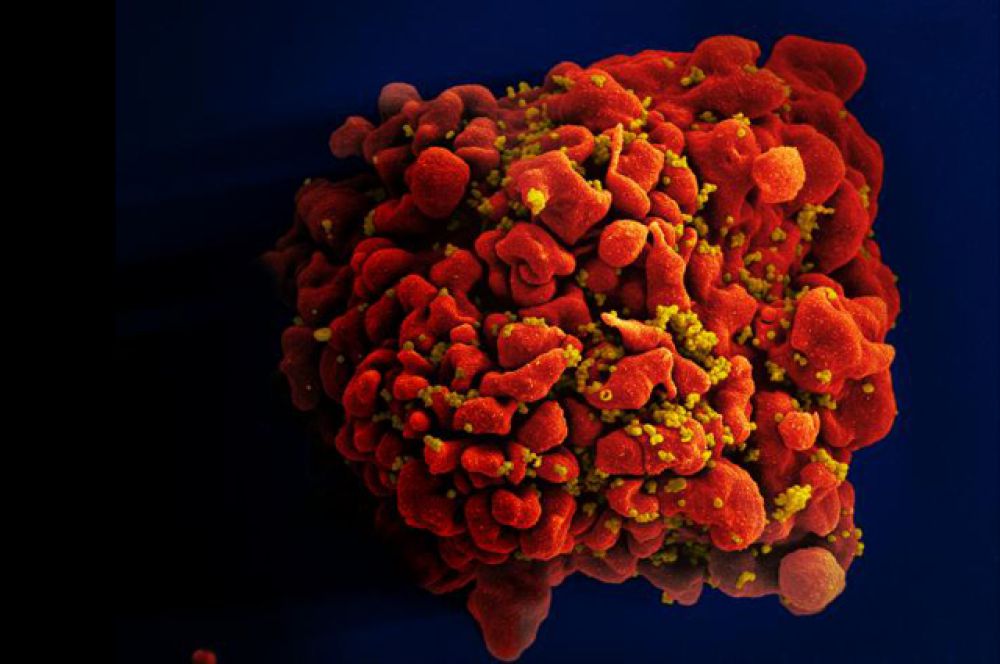 Вирусы гриппа мешают друг другу заражать клетки | Наука и жизнь