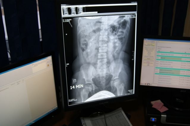 Новый рентген-аппарат появился в ДГКБ №5.