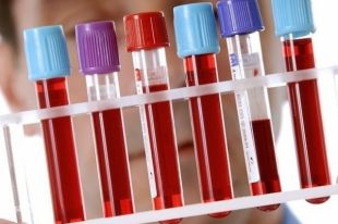 В исследовании приняли участие около 30 тыс. чел