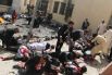 Жуткое и кровавое фото, которое было сделано после взрыва бомбы, заняло первое место в категории «Фото с места событий»