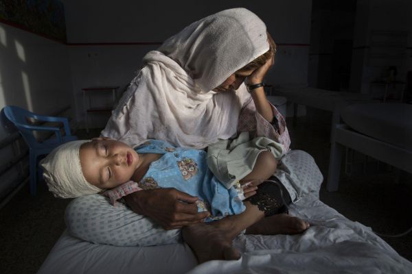 Изображение с матерью, которая держит на руках 2-летнего ребенка, пострадавшего от взрыва бомбы, заняло первое место в категории «Повседневная жизнь»