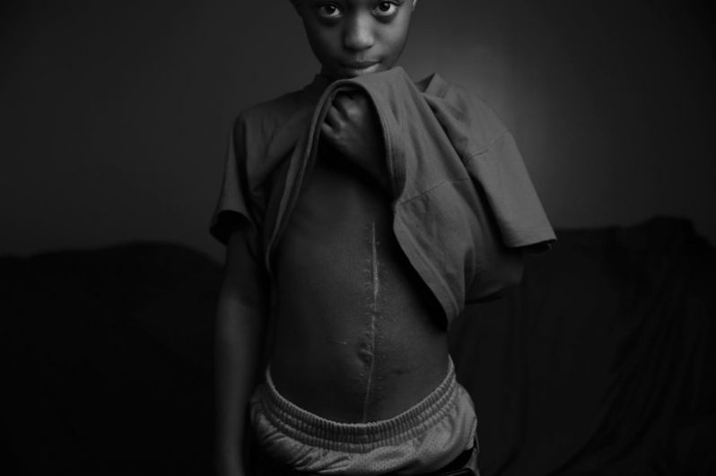 2017 год. Э. Джейсон Уэмбсганс из «Чикаго трибюн» за серию фотографий 10-летнего мальчика и его матери, вернувшей его к жизни после того, как он выжил в стрельбе в Чикаго.
