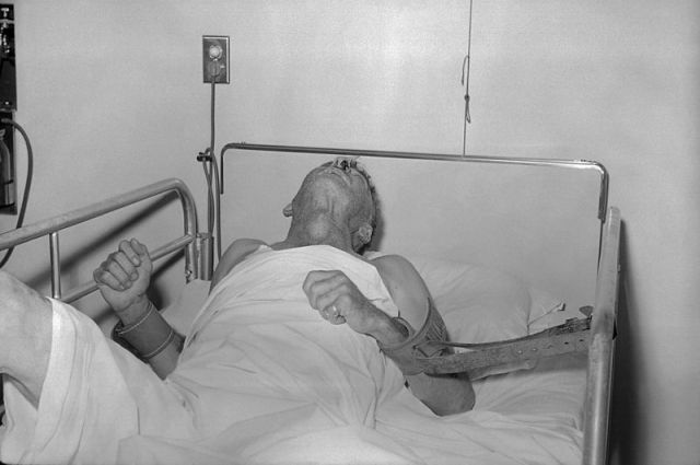 Пациент с симптомами бешенства, 1959 год.