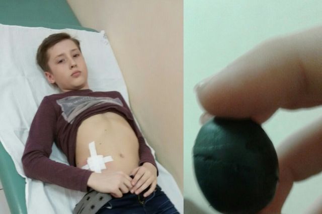 12-летний парень провёл в больнице пять дней.