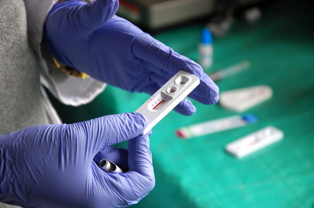 Экспресс-тестирование позволит всего за 15 минут свой ВИЧ статус. 