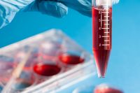 Правила забора и хранения крови для иммунологических исследований