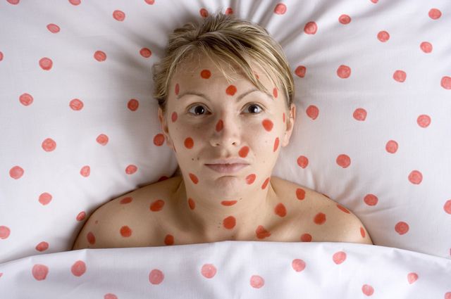 Механизм развития и причины появления высыпаний на коже