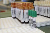 Всего в этом году в Прикамье выявили уже 3322 ВИЧ-инфицированных.