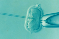 Существует много видов вспомогательных репродуктивных технологий.