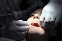 Получить помощь при острой зубной боли можно ежедневно без талонов.