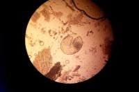 Личинка трематоды из семейства Opisthorchiidae под микроскопом.