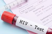 Кузбассовец получил условный срок за намеренное заражение ВИЧ-инфекцией.