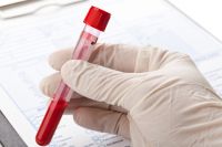 Правила забора и хранения крови для иммунологических исследований thumbnail