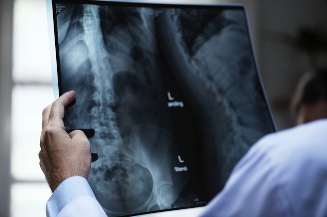В Кузбасской больнице использовали опасные рентгеновские аппараты.