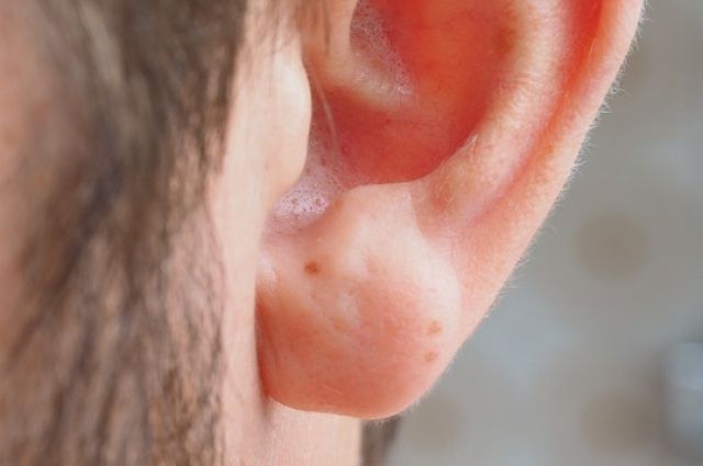 В Тюмени врачи ОКБ №2 вернули слух 50 пациентам