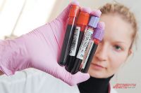 Правила забора и хранения крови для иммунологических исследований