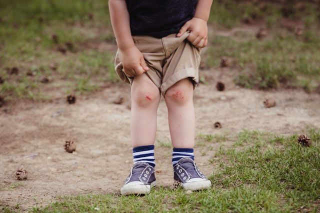 Как быстро вылечить ссадину на коленке: чем намазать рассечение у ребенка