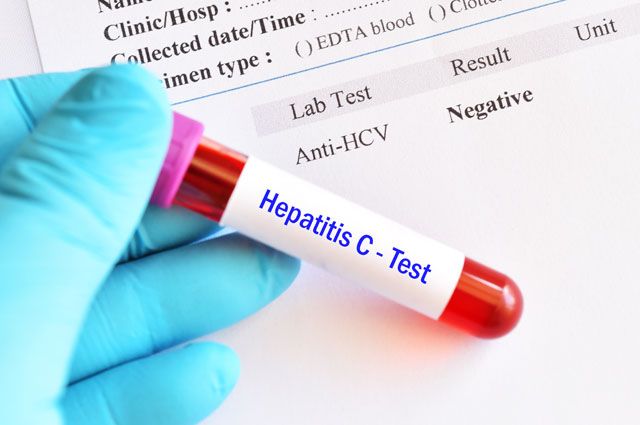 Какие анализы нужно сдавать во время лечения гепатита С