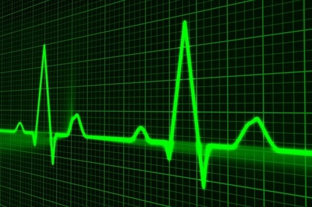 Тюменские врачи подключили кардиостимулятор 100-летней женщине