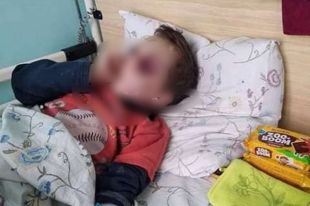 Под Винницей нашли ребенка с гематомами: родителей подозревают в избиении