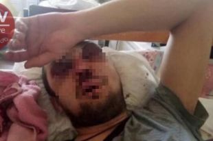 Под Киевом водитель маршрутки за просьбу дать сдачу избил пассажира