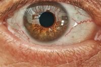 Тюменские медики прооперировали пациента с глаукомой и отслойкой сетчатки