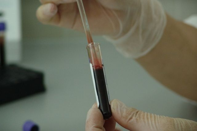 Тюменцы могут пройти экспресс-тестирование на ВИЧ